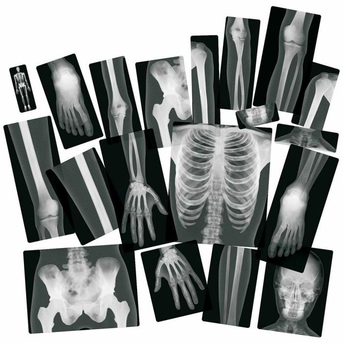 Life Science |   Human X-Rays